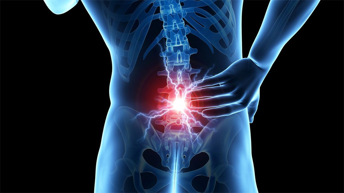 Lombalgia – Le vertebre lombari ed i problemi emozionali associati